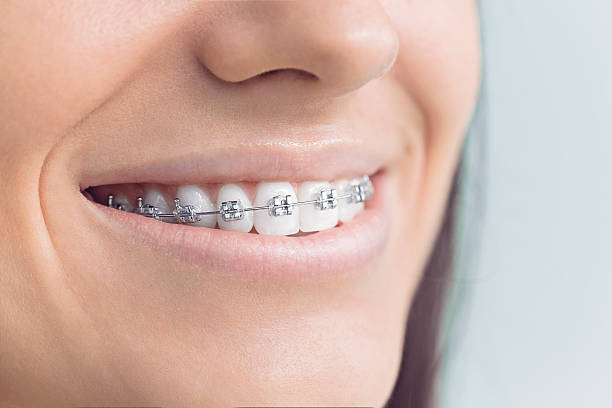 Best Teeth Whitening  in Ortonville, MN